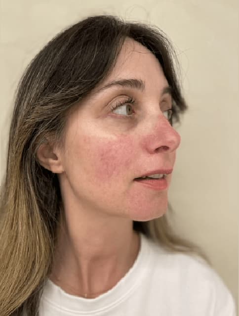 editada dere-8 editada dere-8